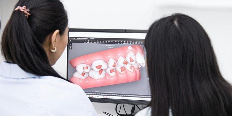 Clinicians reviewing an aligner treatment plan on screen
