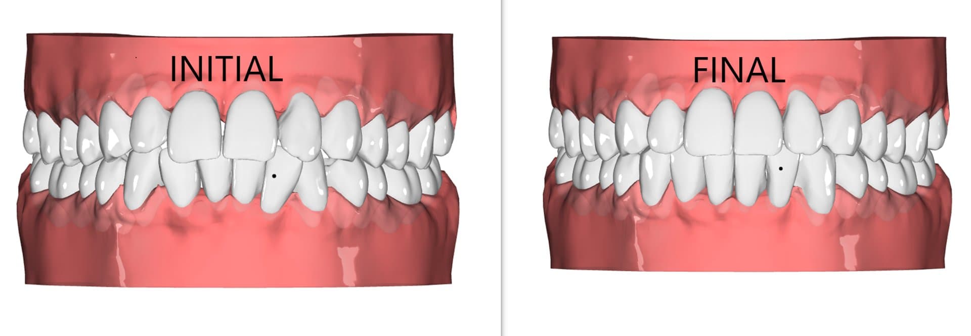 OnyxCeph staging with attachments