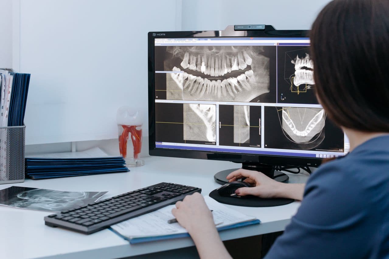 Clinician reviewing panoramic and CBCT dental scans on a monitor